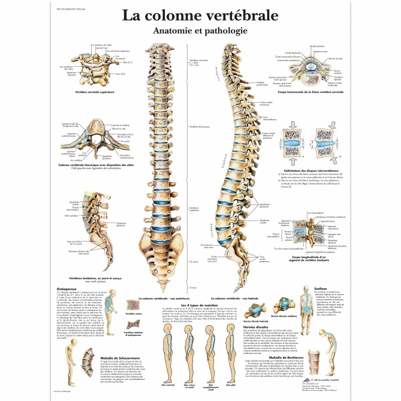 consomed-1709063