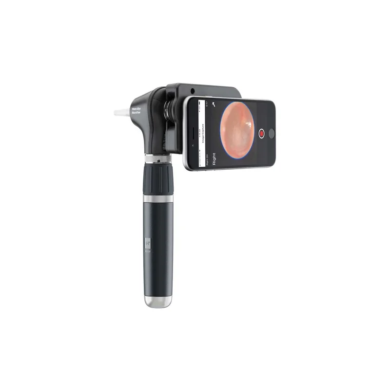 otoscope-macroview-plus-iexaminer-welch-allyn