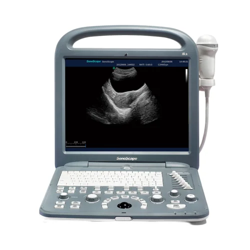 remma-1730697
