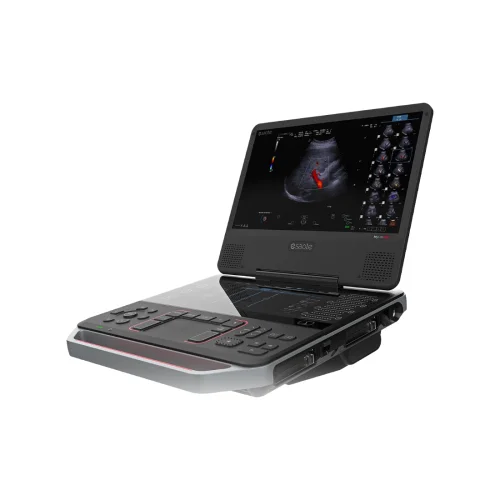 remma-1736970